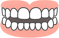 前歯が閉じられない