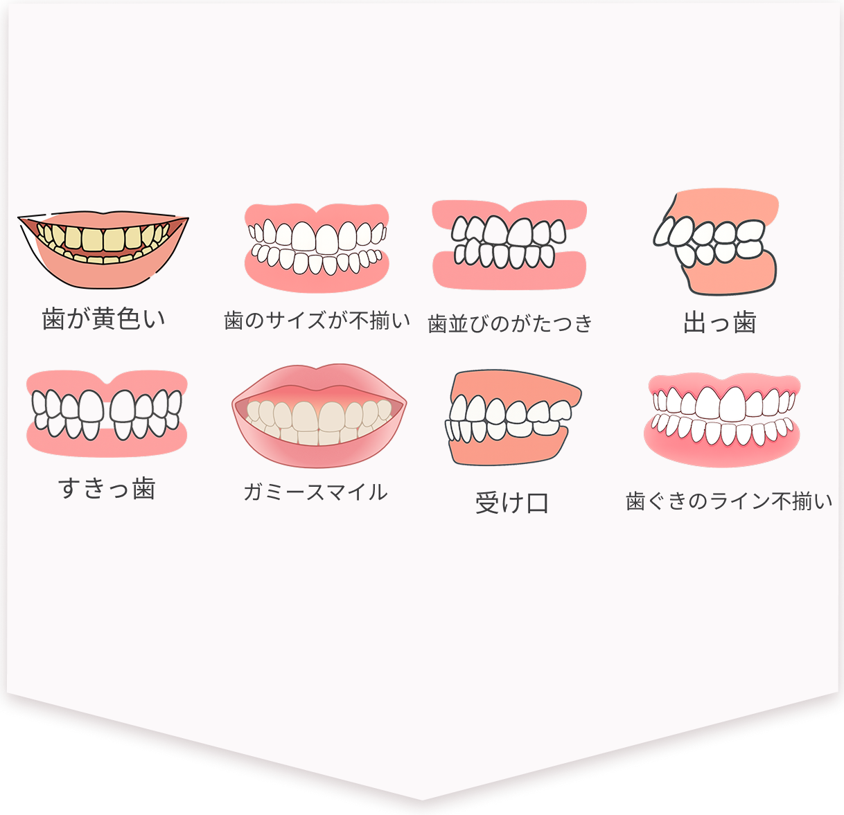 歯が黄色い・歯のサイズが不揃い・歯並びのがたつき・出っ歯・すきっ歯・ガミースマイル・受け口・歯ぐきのライン不揃い・歯科矯正は時間がかかるし治療は諦めている