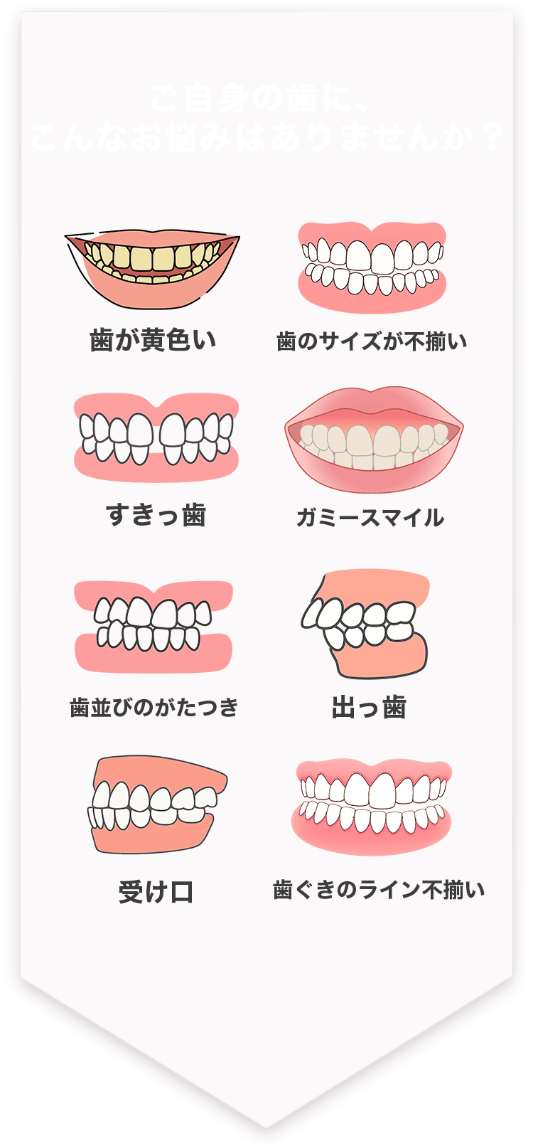歯が黄色い・歯のサイズが不揃い・歯並びのがたつき・出っ歯・すきっ歯・ガミースマイル・受け口・歯ぐきのライン不揃い・歯科矯正は時間がかかるし治療は諦めている