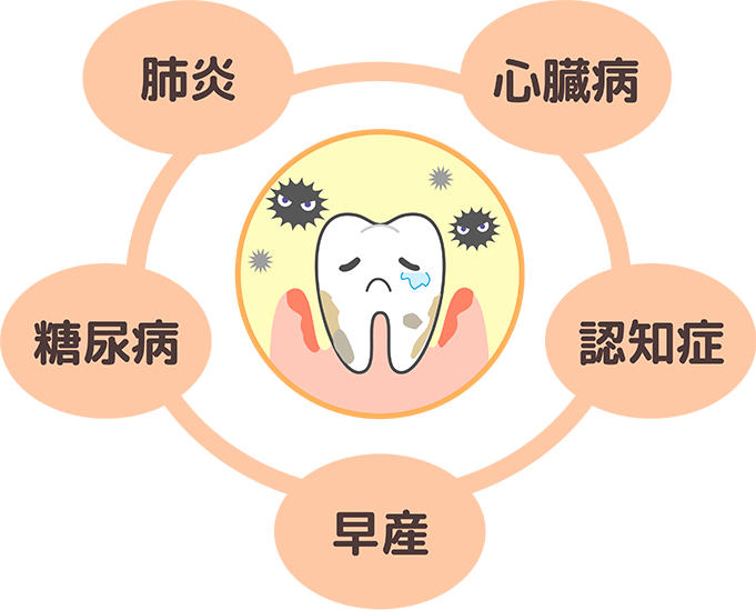 歯周病が全身に与える影響