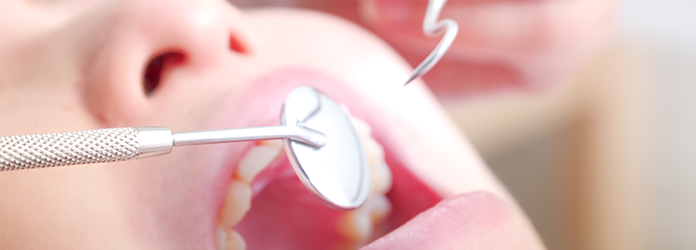 定期検診・管理