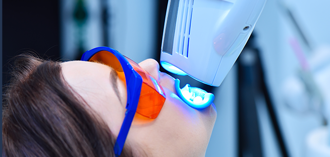 オフィスホワイトニング